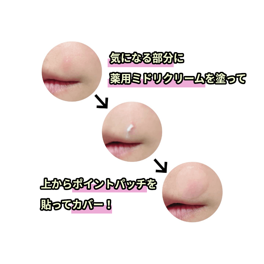 アクネスラボ 相澤メソッド 薬用ミドリクリーム【医薬部外品】