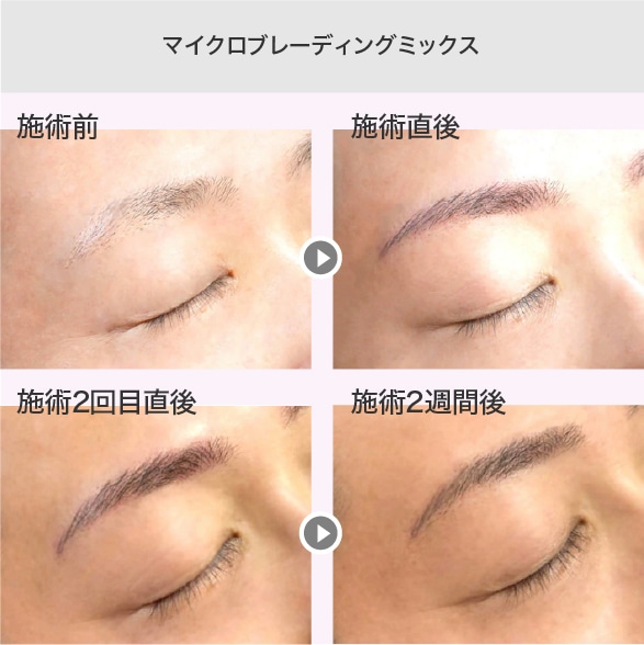 ̵����������ʹ�����ư��ť����ȥᥤ�������������� ����ա��Ǹ�ա����ŵ��ؤ�������