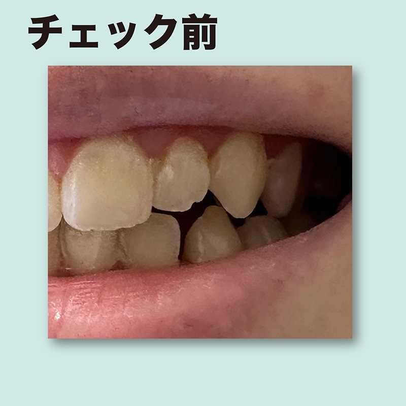 �ǥ󥿥�ץ顼���������å��饤��