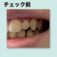 �ǥ󥿥�ץ顼���������å��饤��