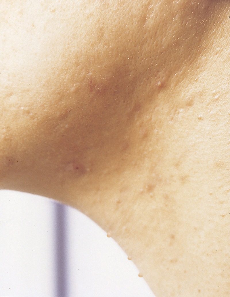 �ȥߡ���å����ϥȥ����ȩ�Ĥ��ӥ塼�ƥ�������3