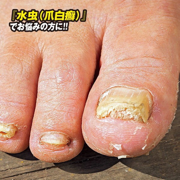 家庭用紫外線治療器ボディドクターUV2｜メルシーオンラインショップ