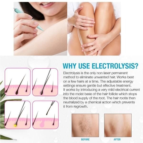 Clean and Easy Deluxe Home Electrolysis 家庭用電気脱毛器