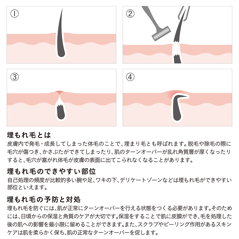 iroha VIO トリートメント ローション 100ml