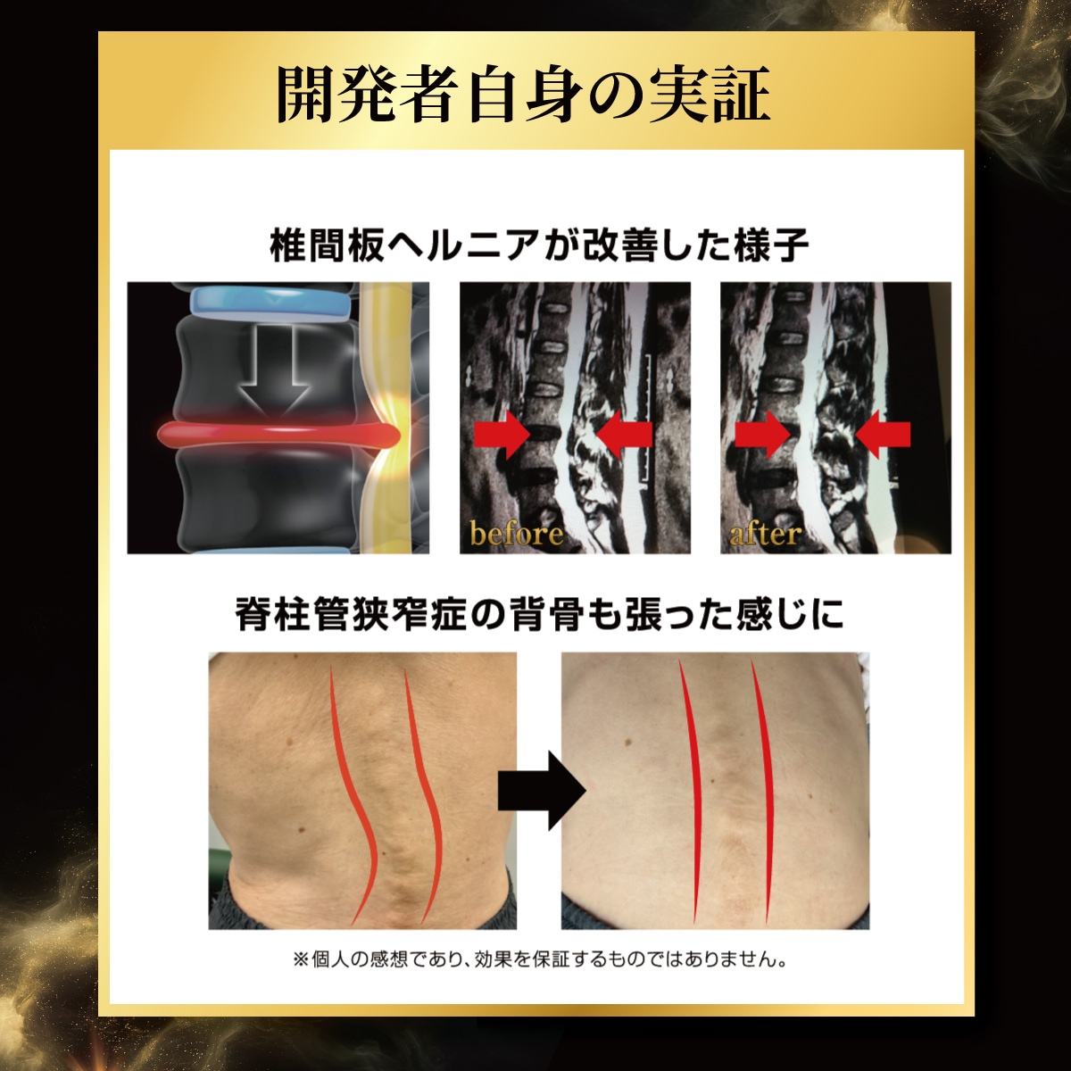 脊柱の圧力を解放 グラビリィ 