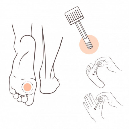 【プラナロム】　いぼ・皮膚トラブルのケア　《手・足の抗感染、抗真菌、洗浄、抗炎症作用に》　（アロマデルム　ローション）　10ml　【Pranarom-Lotion Aromaderm pieds et mains】