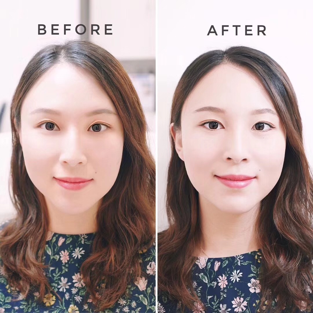 ST������24��(J������/�ץ�ߥ��ॷ�륯��������)