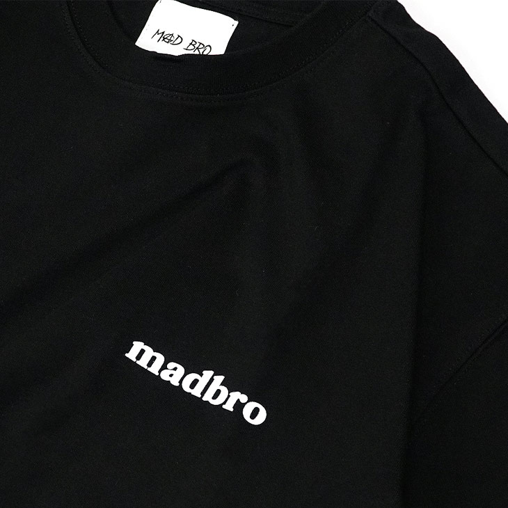 Perogonia TEE
