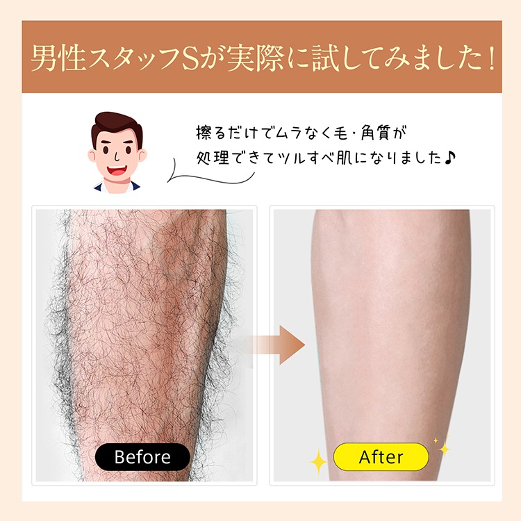 ガラス脱毛器 sg319