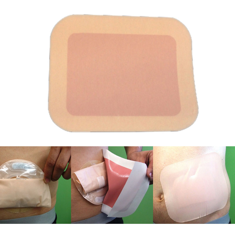 ユーケアーCc ストーマパウチ10枚X12箱 【公式通販】