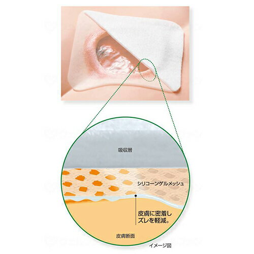 アルケア エスアイエイド（3枚入） 5号（3枚） 18762創傷治療