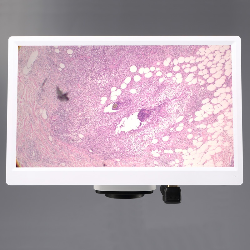 ʰ¬굡ǽ¢˥ηCޥȥ顡HD1500MM