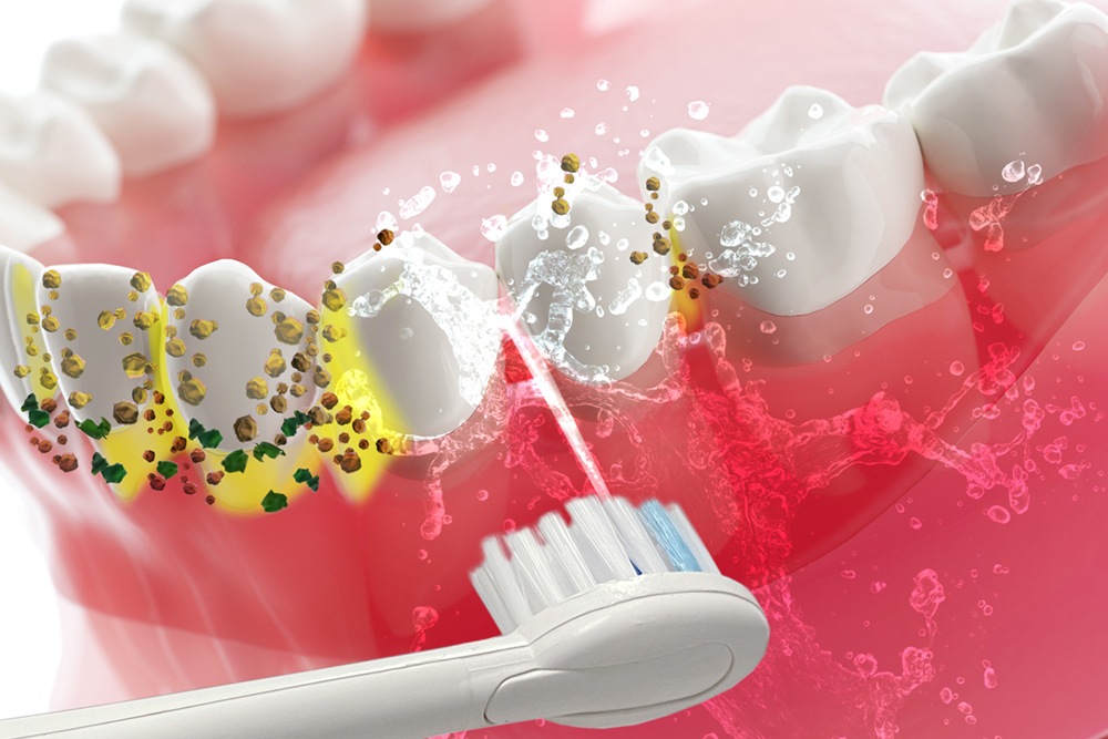 EXELUX<br>パーフェクトダブルケア<br>2in1ブラシ＆フロス　コンパクト