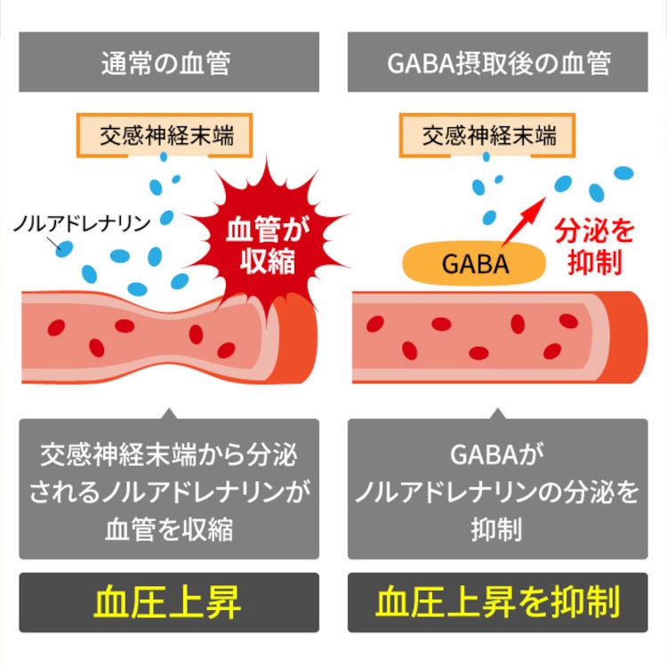 �찵�߷��� W����