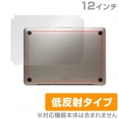 OverLay Plus for MacBook 12 ΢ݸ