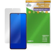 Samsung Galaxy S21 5G �ݸ�ե���� OverLay Plus Lite for ����饯���� �վ��ݸ� �����ٱվ��б� ��������쥢 ȿ���ɻ� �����ɻ�