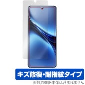 vivo X200 Pro 保護 フィルム OverLay Magic for ヴィーヴォ スマートフォン 液晶保護 傷修復 耐指紋 指紋防止 コーティング|SIMロックフリー端末|スマートフォン・携