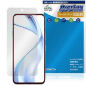 ͽʡ825вٳͽarrows Alpha M08 / F-51F ݸ ե OverLay Eye Protector ȿ for  ե վݸ ֥롼饤ȥå ȿɻ