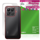 Xiaomi 15T Pro  ݸ ե OverLay Paper for 㥪ߡ ޡȥե 饶餷꿨 ۡɴå