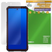 RugOne Xever 7 �ݸ�ե���� OverLay Plus Lite for ���ޡ��ȥե��� �վ��ݸ� �����ٱվ��б� ��������쥢 ȿ���ɻ� ����� �����ɻ�