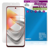 nubia S2e /nubia S2R �ݸ�ե���� OverLay FLEX ����� for �̥ӥ� ���� �վ��ݸ� �����б� �����Ǻ� �׷�ۼ� Ʃ��