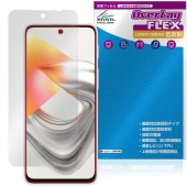 nubia S2e /nubia S2R �ݸ�ե���� OverLay FLEX ��ȿ�� for �̥ӥ� ���� �վ��ݸ� �����б� �����Ǻ� ȿ���ɻ� �׷�ۼ�