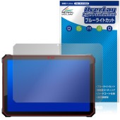 Blackview Active 12 Pro �ݸ�ե���� OverLay Eye Protector for �֥�å��ӥ塼 �����ƥ��� �վ��ݸ� �ܤ�ͥ���� �֥롼�饤�ȥ��å�