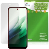 Xiaomi REDMI 15 5G �ݸ�ե���� OverLay Brilliant for ���㥪�ߡ� ��åɥߡ� �վ��ݸ� ���椬�Ĥ��ˤ��� �����ɻ� �����