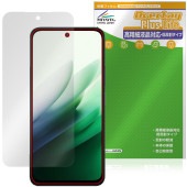 Xiaomi REDMI 15 5G �ݸ�ե���� OverLay Plus Lite for ���㥪�ߡ� ��åɥߡ� �����ٱվ��б� ��������쥢 ȿ���ɻ� ����� �����ɻ�
