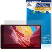 LUCA Tablet 14����� TM14D1M76-V1B �ݸ�ե���� OverLay Eye Protector ��ȿ�� for �����ꥹ������� �륫 ���֥�å� �ܤ�ͥ����