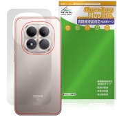 Xiaomi REDMI Note 15 Pro 5G ���� �ݸ�ե���� OverLay Plus Lite for ���㥪�ߡ� ��ɥ� �Ρ��� �ץ� �����ݸ� ���餵��꿨�� ��ȿ��