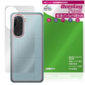 Xiaomi POCO M7 4G ���� �ݸ�ե���� OverLay Paper for ���㥪�ߡ� �ݥ� ���ޡ��ȥե��� ���饶�餷���꿨�� �ۡ���ɴ����å�