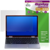 TENKU MOBILE S10�� �ݸ�ե���� OverLay Absorber ��ȿ�� for ŷ�� �����Ρ��ȥѥ����� �׷�ۼ� ȿ���ɻ� �֥롼�饤�ȥ��å� ����