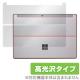 OverLay Brilliant for Surface 3 ΢�����ݸ����