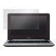 OverLay Brilliant for ASUS Chromebook C202SA / C200MA