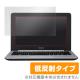 OverLay Plus for ASUS Chromebook C202SA / C200MA