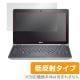 OverLay Plus for Dell Latitude E6230