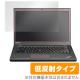 OverLay Plus for ThinkPad T450/T460S (åѥͥ뵡ǽܥǥ)