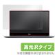 OverLay Brilliant for Dell XPS 13 (9360/9350) (åѥͥ뵡ǽܥǥ)