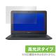 Acer Chromebook 11 / Chromebook 11 LTE (C732���꡼��) �� �ݸ� �ե���� OverLay Brilliant for Acer Chromebook 11 / Chromebook 11 LTE (C732���꡼��) �վ� �ݸ� ���椬�Ĥ��ˤ��� �ɻ��� �����
