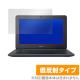 Acer Chromebook 11 / Chromebook 11 LTE (C732���꡼��) �� �ݸ� �ե���� OverLay Plus for Acer Chromebook 11 / Chromebook 11 LTE (C732���꡼��) �վ� �ݸ� ��������쥢 ����� ��ȿ��