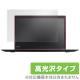 OverLay Brilliant for ThinkPad X1 Yoga (2017ǯ��ǥ�)