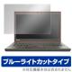 OverLay Eye Protector for ThinkPad T450s (åѥͥ뵡ǽܥǥ)