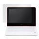 OverLay Plus for HP x360 11-ab000 ���꡼��