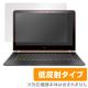 OverLay Plus for HP Spectre 13-v000 ���꡼��