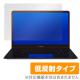 OverLay Plus for ASUS ZenBook Pro 15 UX580