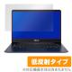 OverLay Plus for ASUS ZenBook 14 UX430UN / UX430UA