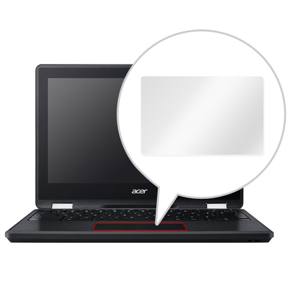 OverLay Protector for �ȥ�å��ѥå� Acer Chromebook Spin 11