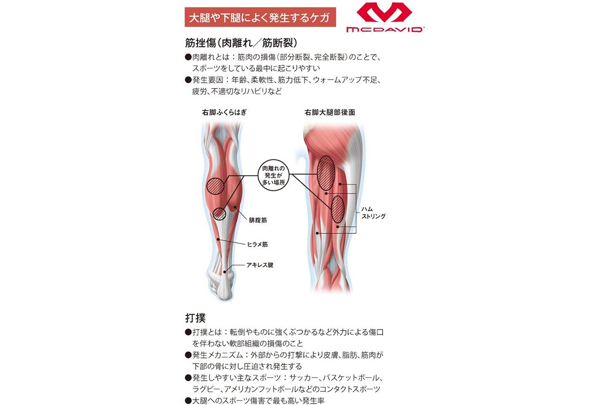希少 スポーツケア用品 Mcdavid グロインラップ 左右兼用 フリー ブラック Bk Shipsctc Org 希少 スポーツケア用品 Mcdavid グロインラップ 左右兼用 フリー ブラック Bk Shipsctc Org
