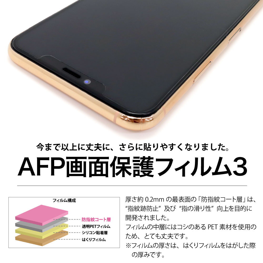 Xiaomi Redmi Note 10T ѡAFPݸե3